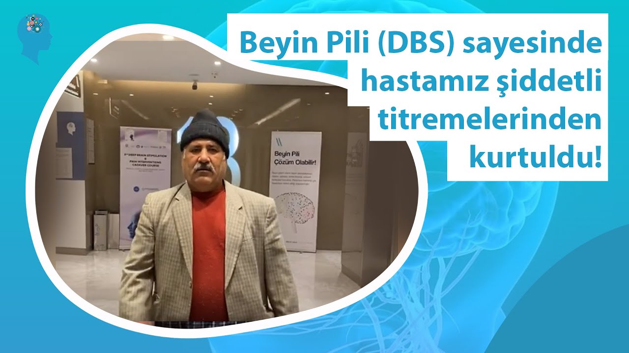 Beyin Pili (DBS) ameliyatı sayesinde parkinson hastamız şiddetli titremelerinden kurtuldu.