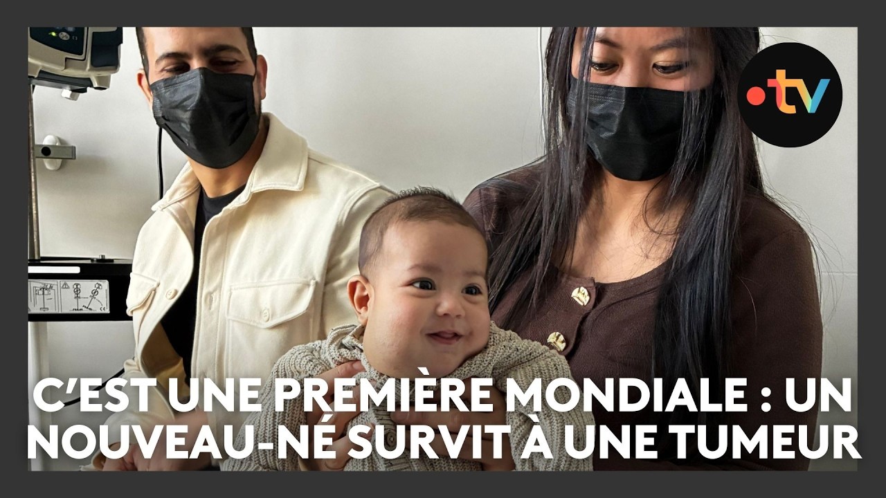 Pour la première fois au monde, un nouveau-né survit à une tumeur