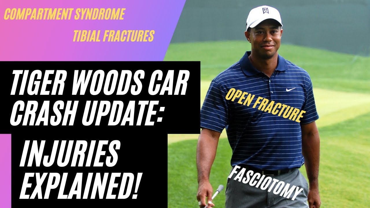 Tiger Woods Car Crash Injuries Update: Tibial fracture, compartment syndrome, fasciotomy!