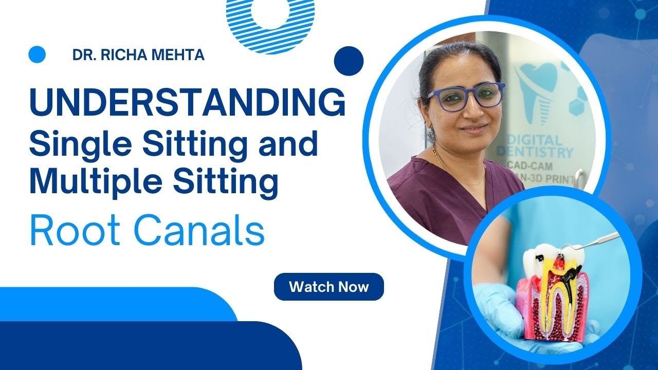 Understanding Single Sitting and Multiple Sitting Root Canals – Dr. Richa Explains!