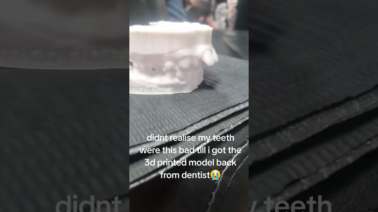 Dentist Reveals The DANGERS of Sucking Your Thumb! 👍🦷
