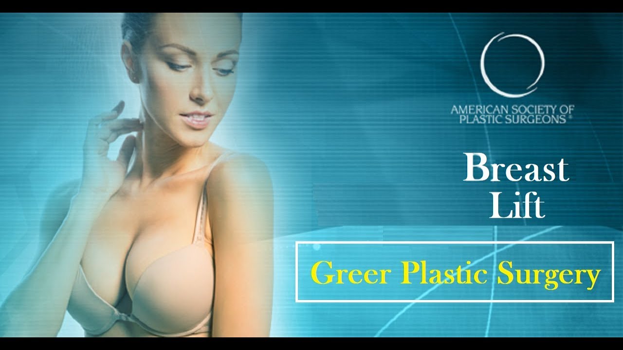 Sagging Breasts In Mentor Ohio ~ Mastopexy Option Available