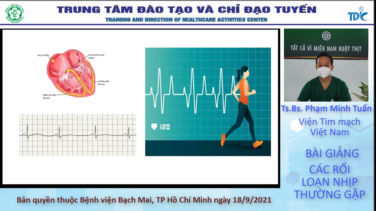 Nhận biết các rối loạn nhịp tim thường gặp