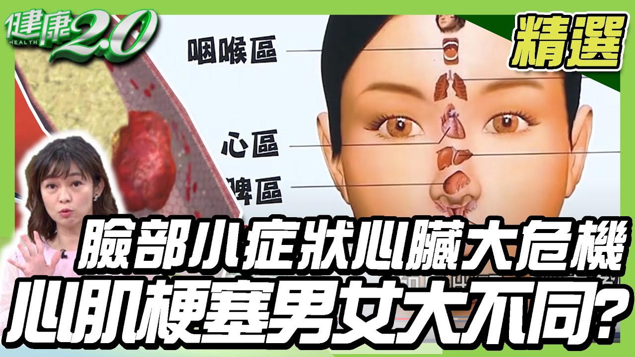 臉部小症狀心臟大危機 心肌梗塞男女大不同?【健康2.0精選】