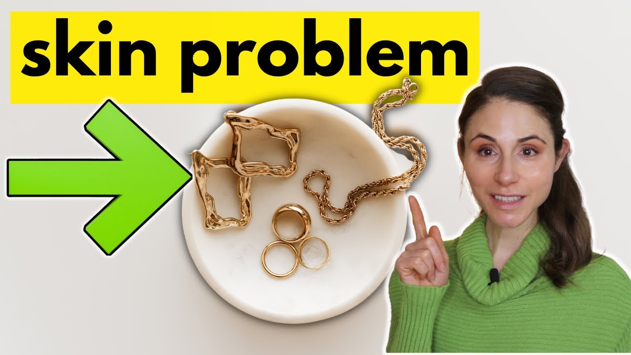 Your Skin Problem Might Be Because Of Your Jewelry!