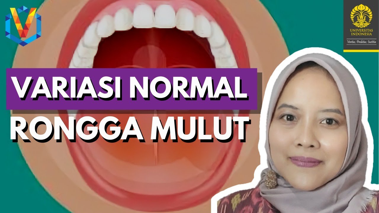 Variasi Normal di Mulut, Bahaya Nggak Sih?