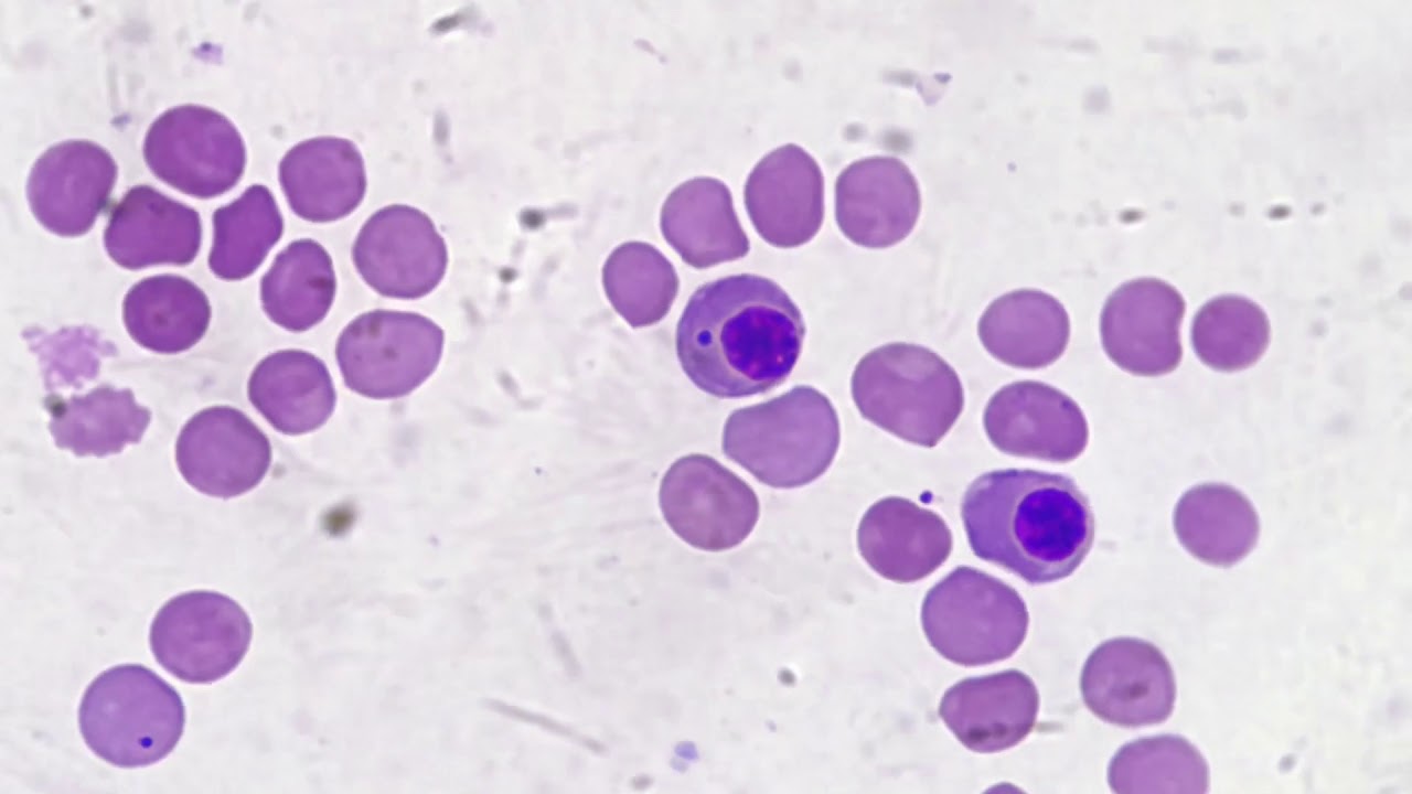 Nucleated RBCs