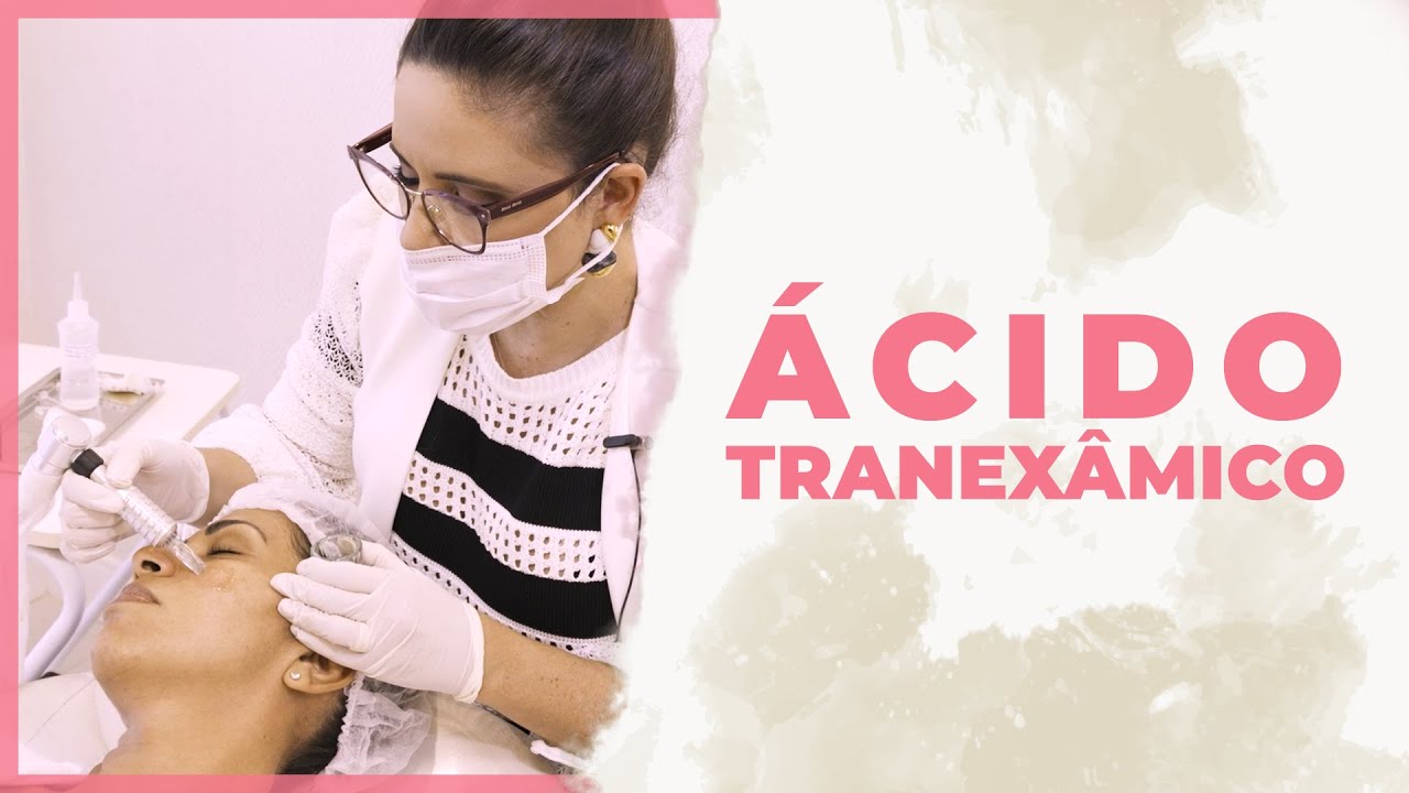 Ácido Tranexâmico no Melasma