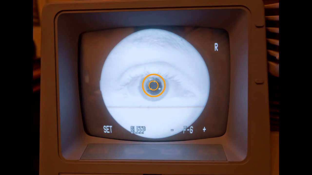 CR DGi Retinal Camera Functions