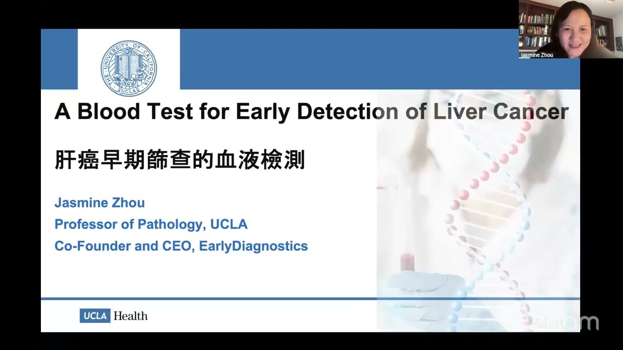 肝癌早期篩查的血液檢測 - MethylScan HCC, Jasmine Zhou, EarlyDx, UCLA