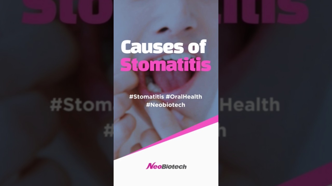 Причины стоматита | Neobiotech