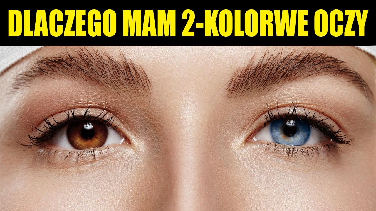 Dlaczego mam 2-kolorowe oczy? QnA