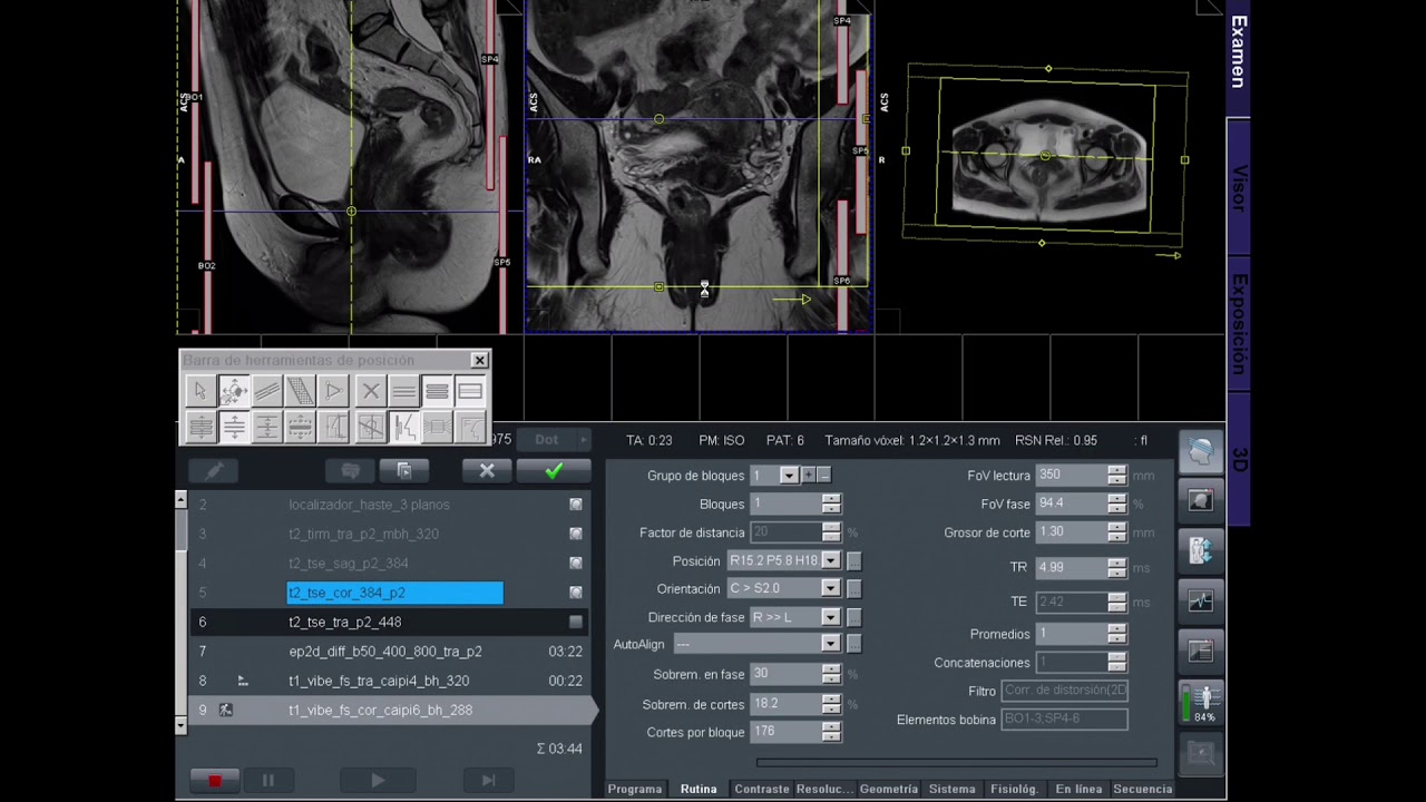 PROTOCOLO PELVIS BLANDA + DEFECOGRAFIA