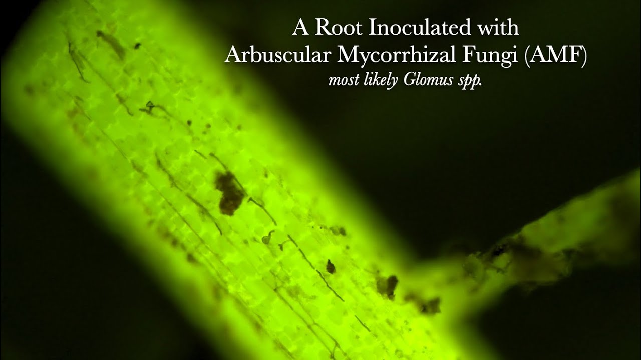 Arbuscular Mycorrhizal Fungi (AMF) seen with Epifluorescence Microscopy