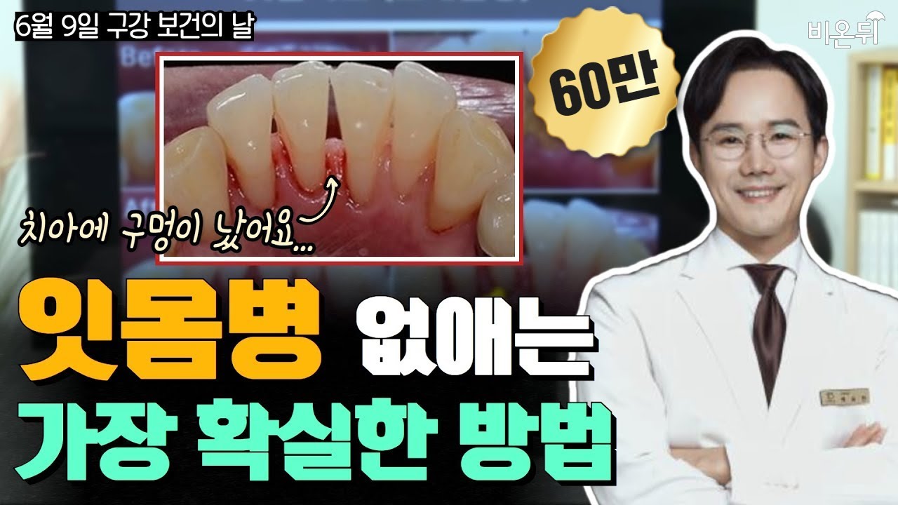 잇몸병 없애는 가장 확실한 방법 | 잇몸치료 건강보험 혜택 1년에 4번, 모두 받는 사람 아무도 없을걸? (닥터배치과 배승한)
