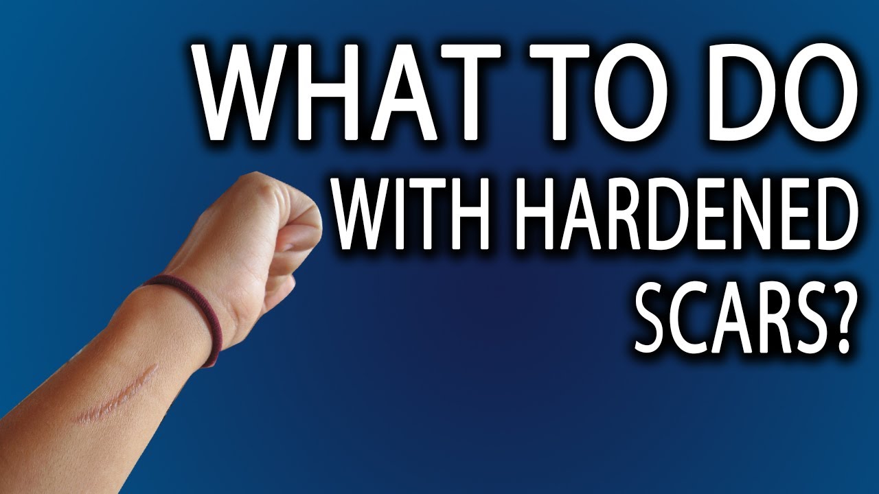 How To Heal Hardened Scar Tissue