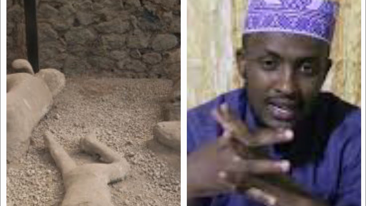 Q3aad Qoomu Luudka casrigan iyo Qaabka looga hortago.