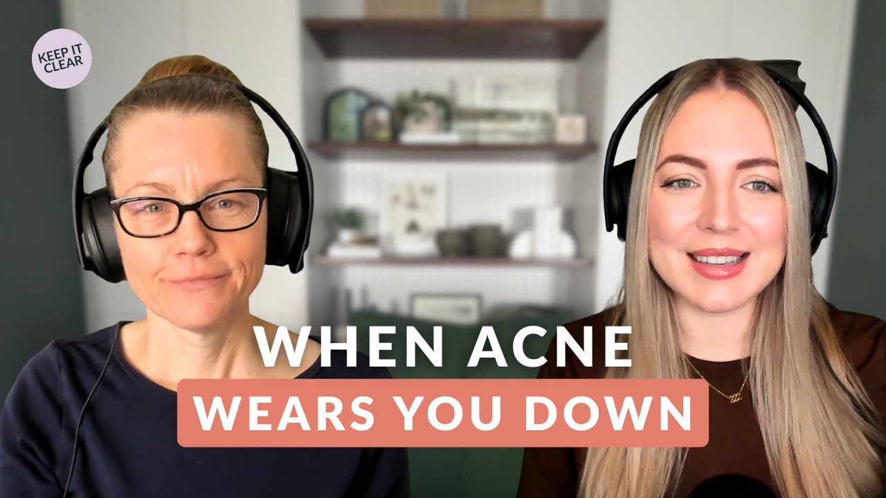 Acne Burnout: Why You’re Exhausted From Trying to Clear Your Skin (And What Helps)