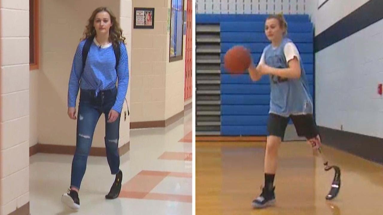 16-Year-Old Plays Basketball With Prosthetic Leg