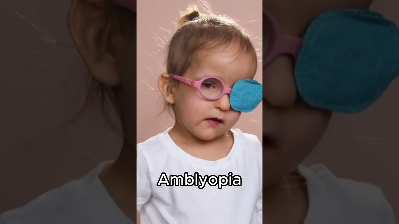 Top 5 pediatric eye conditions!