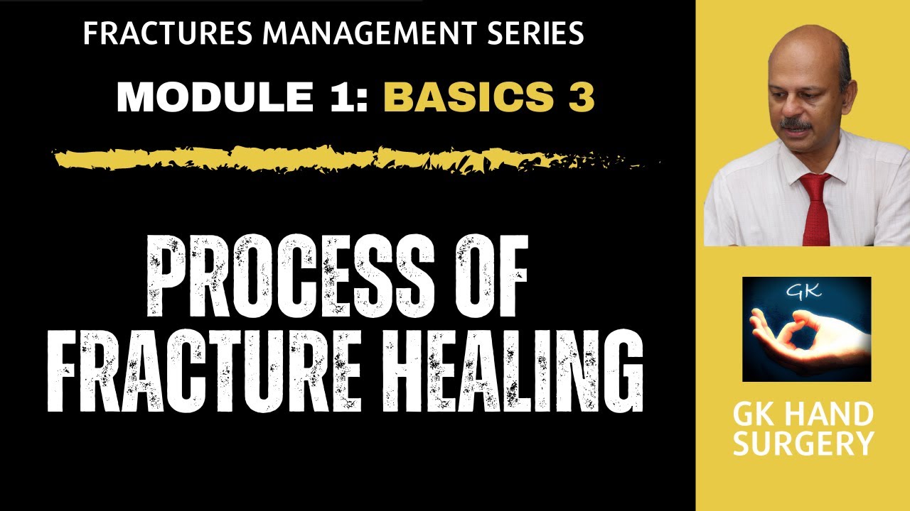 Hand fractures: Basics 3 - Processes of fracture healing - Direct and indirect healing phases.
