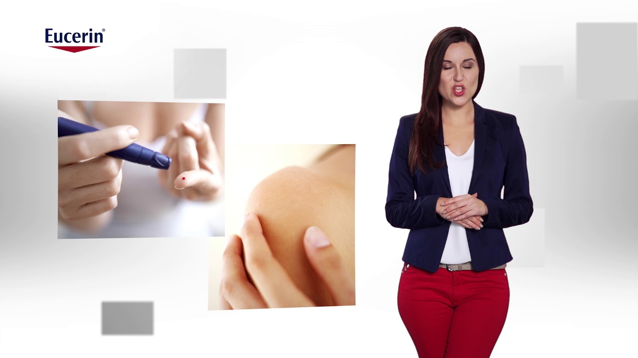 Dry Skin and Diabetes