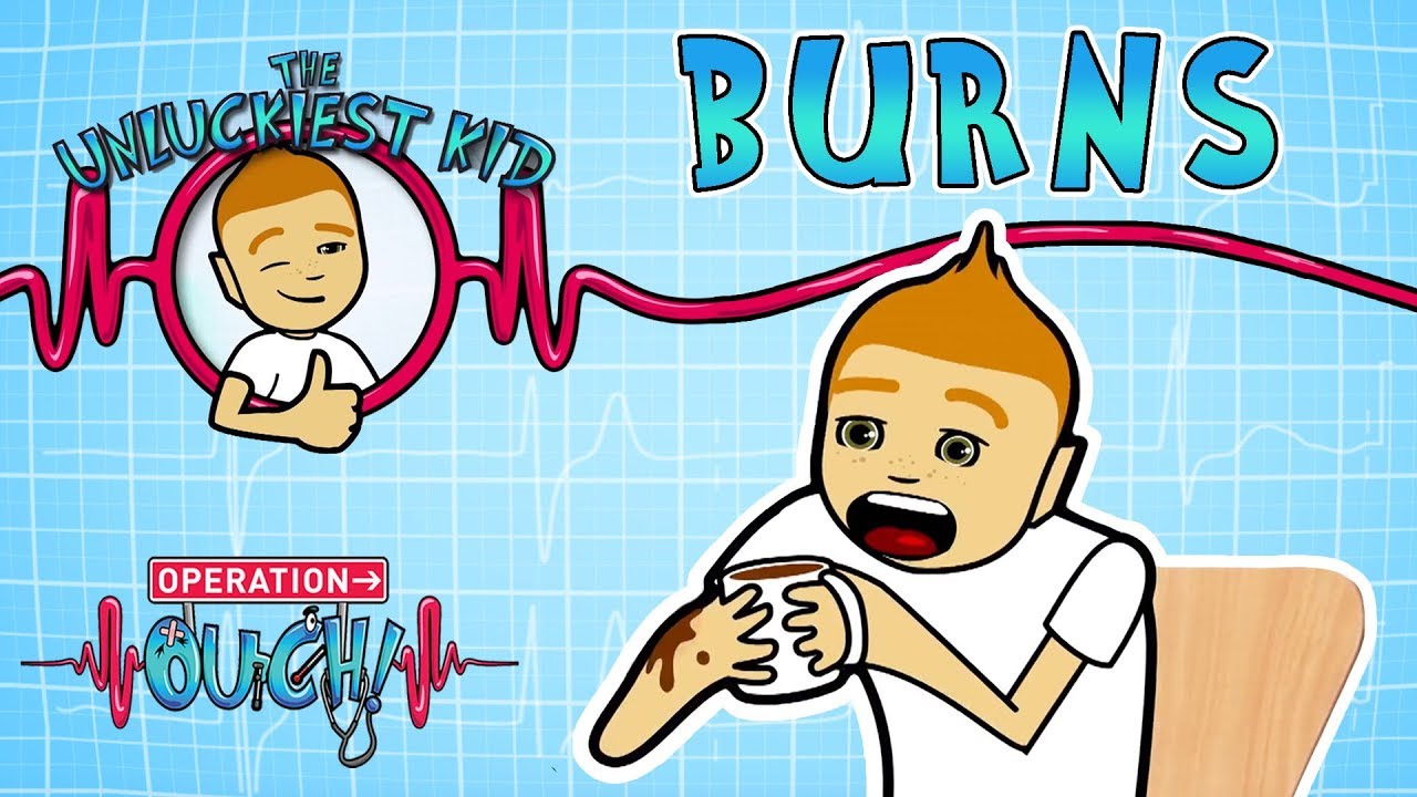 Science for kids - Bad Burns | Experiments for kids | Operation Ouch