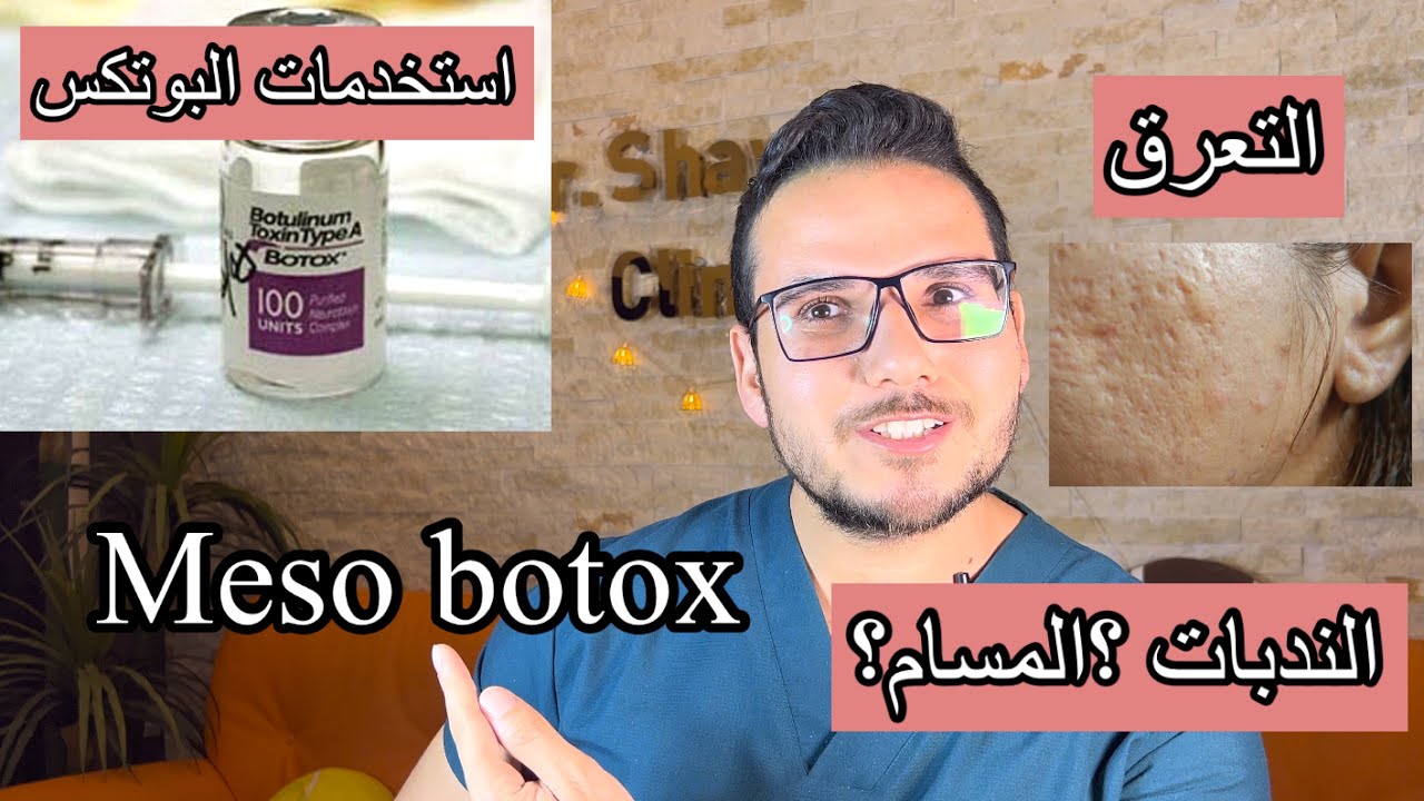 استخدمات البوتكس  والميزو بوتكس بعيدا عن علاج التجاعيد