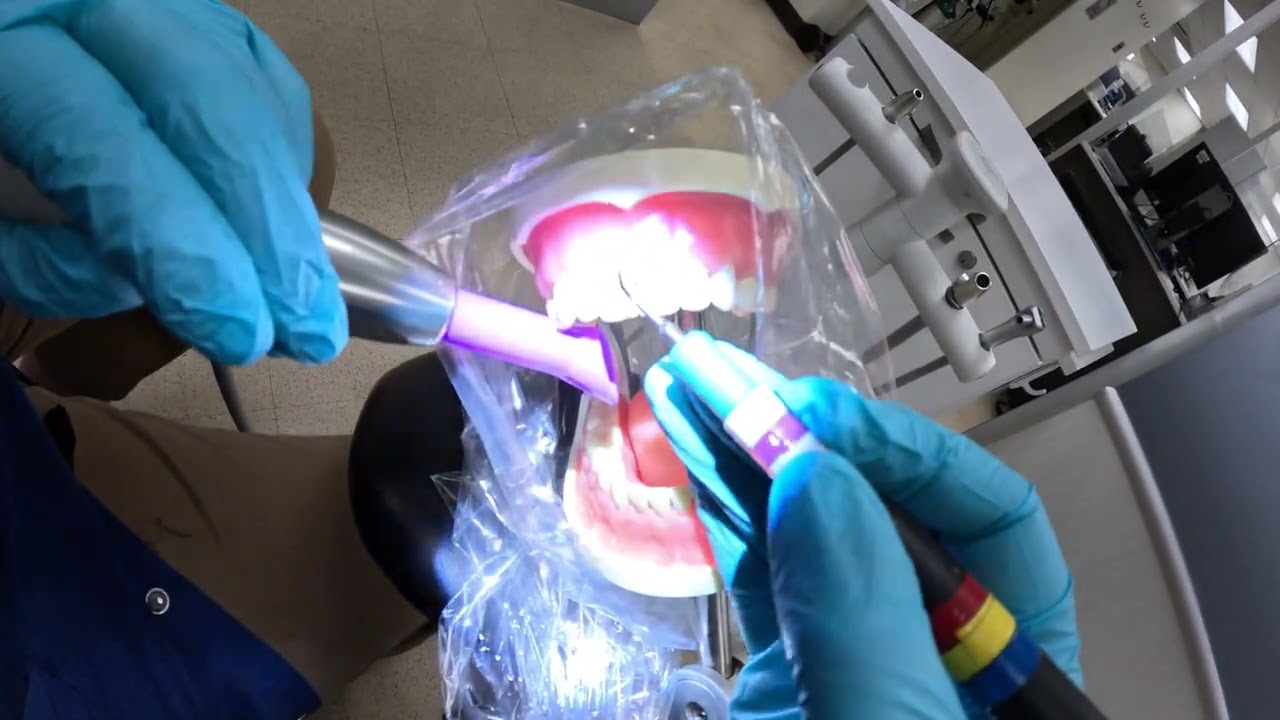 Ultrasonic typodont maxillary anterior for the dental hygiene program and beyond