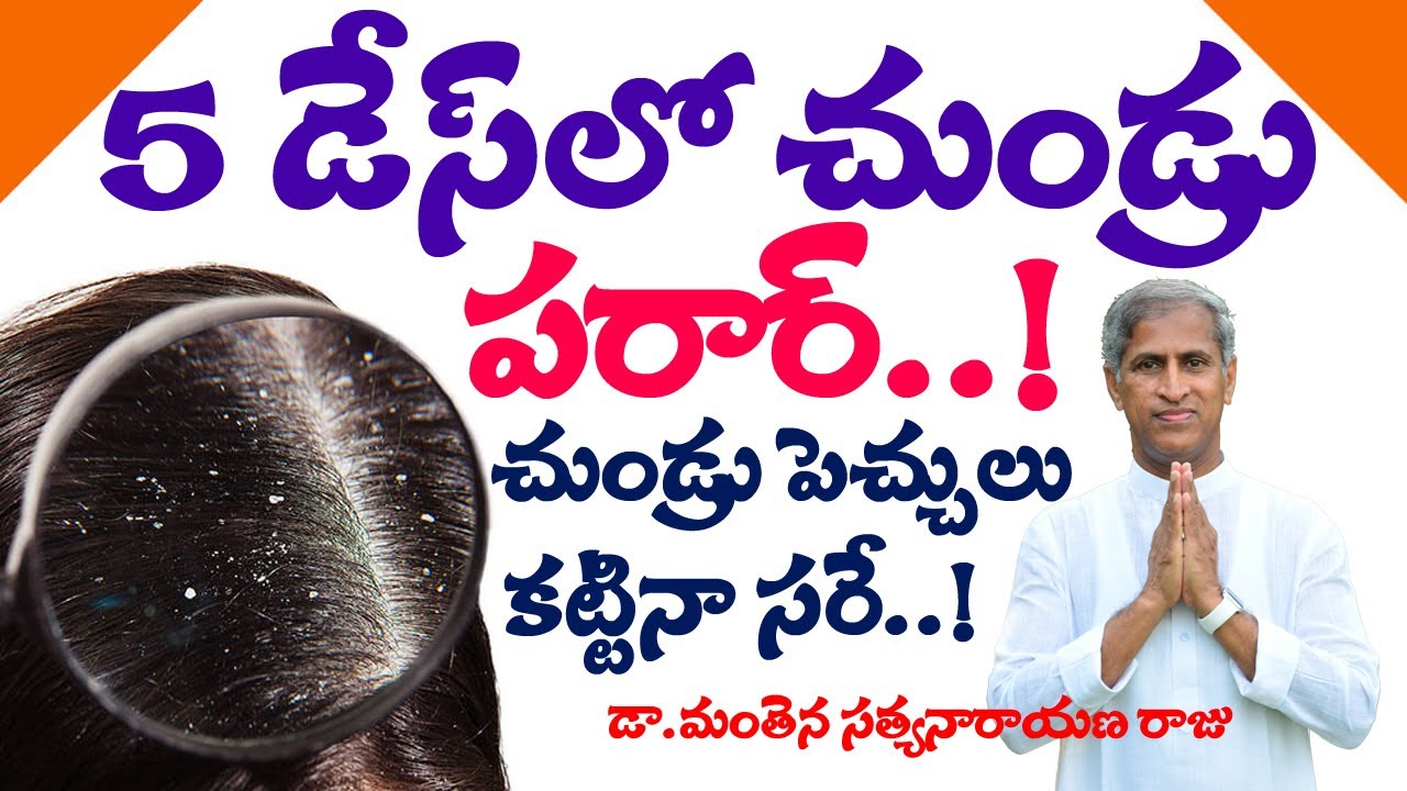 Dandruff | సింపుల్ చిట్కాతో చుండ్రుకి చెక్ | Chundru povalante | Dr Manthena Satyanarayana Raju