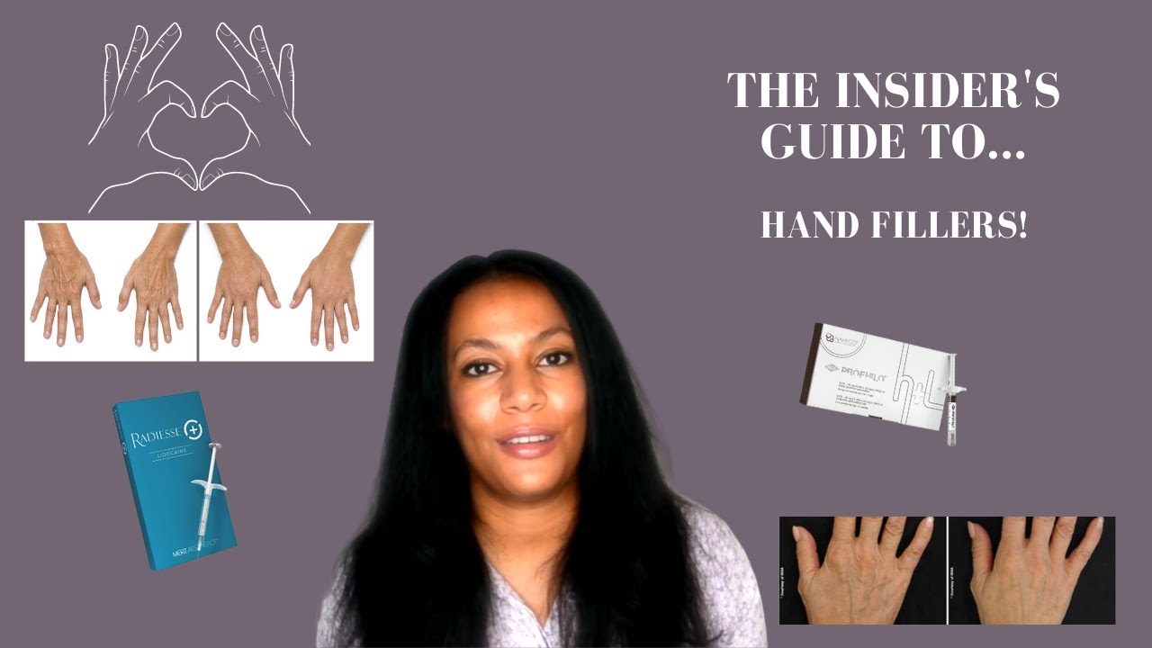 All About Hand Fillers! What is the best filler for your hands?