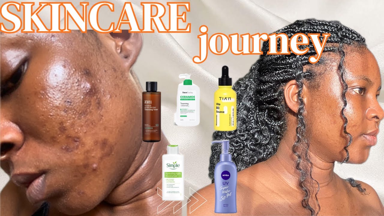 My Skincare Journey + Morning Routine: How I Use Niacinamide & Repair My Skin Barrier