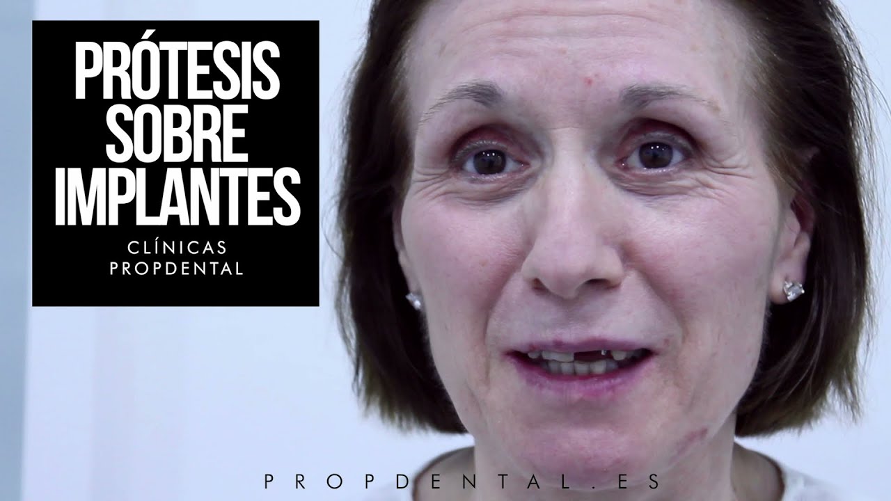 Testimonio rehabilitación con implantes dentales