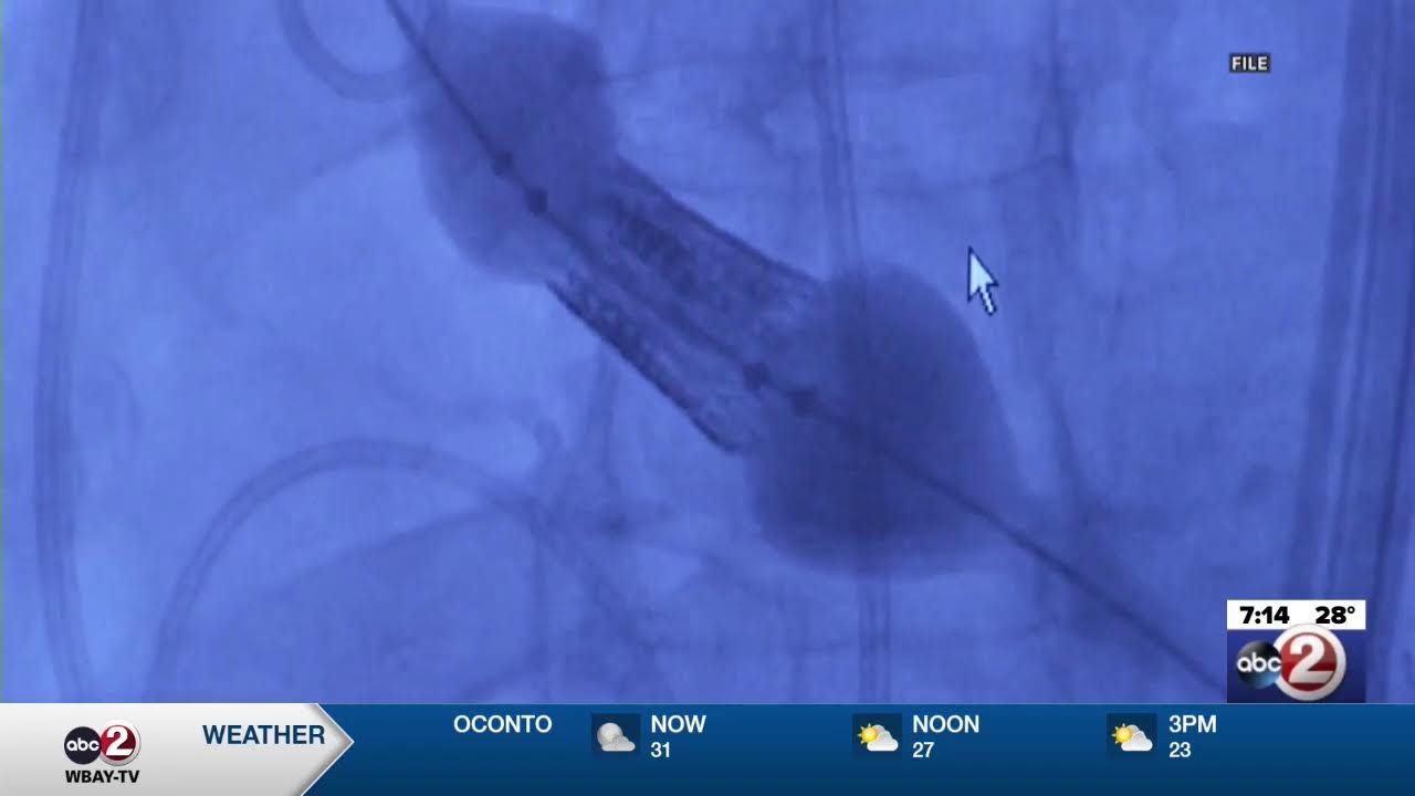 2/6/2026 Action 2 News This Morning: LIVESTREAM