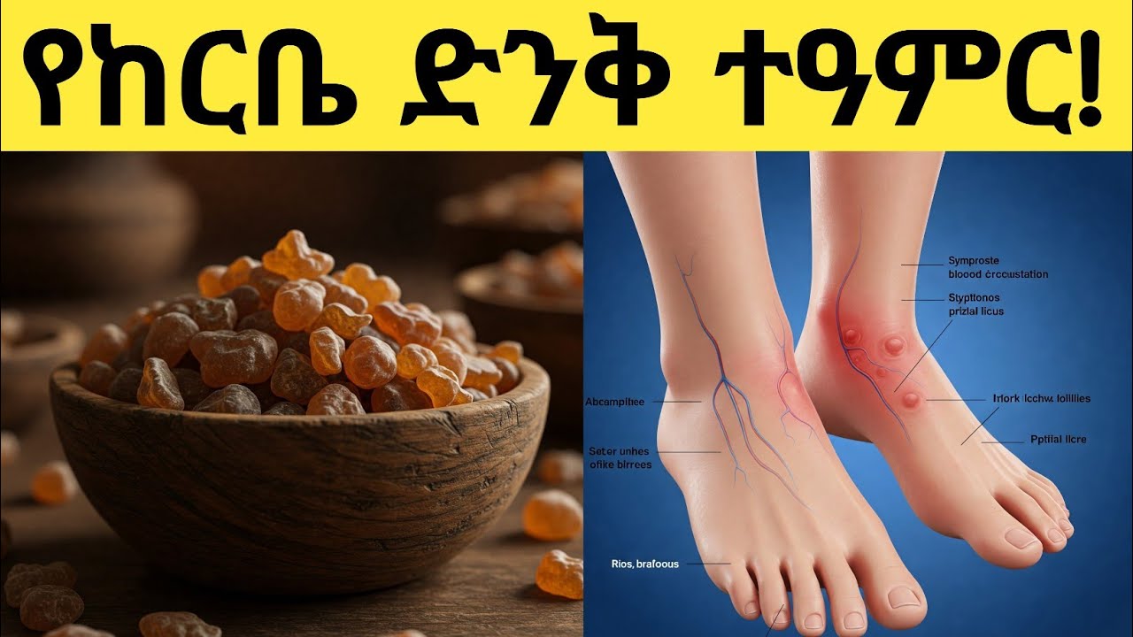 የከርቤ አስደናቂ የጤና ጥቅምች,ጉዳቱ,አጠቃቀም እና መጠቀም የሌለባቸው ሰዎች| amazing health benefits of myrrh, its harms, uses