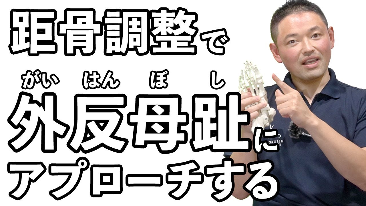 【外反母趾の改善②】もう我慢しない！外反母趾の距骨アプローチ