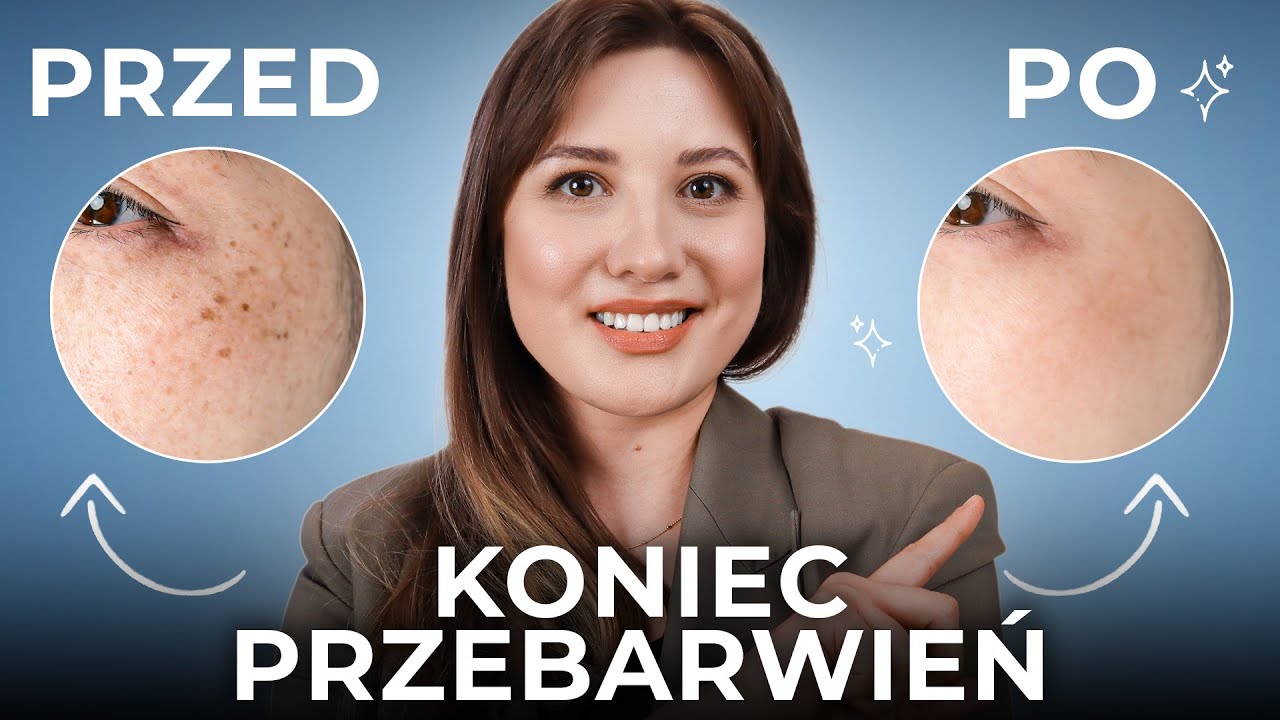 Co na PRZEBARWIENIA na twarzy❓ Jak się ich pozbyć❓ Odkryj najlepsze składniki aktywne ✅
