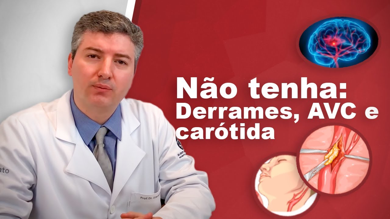 Dr Alexandre Amato Revela os Segredos da Prevenção de Derrames