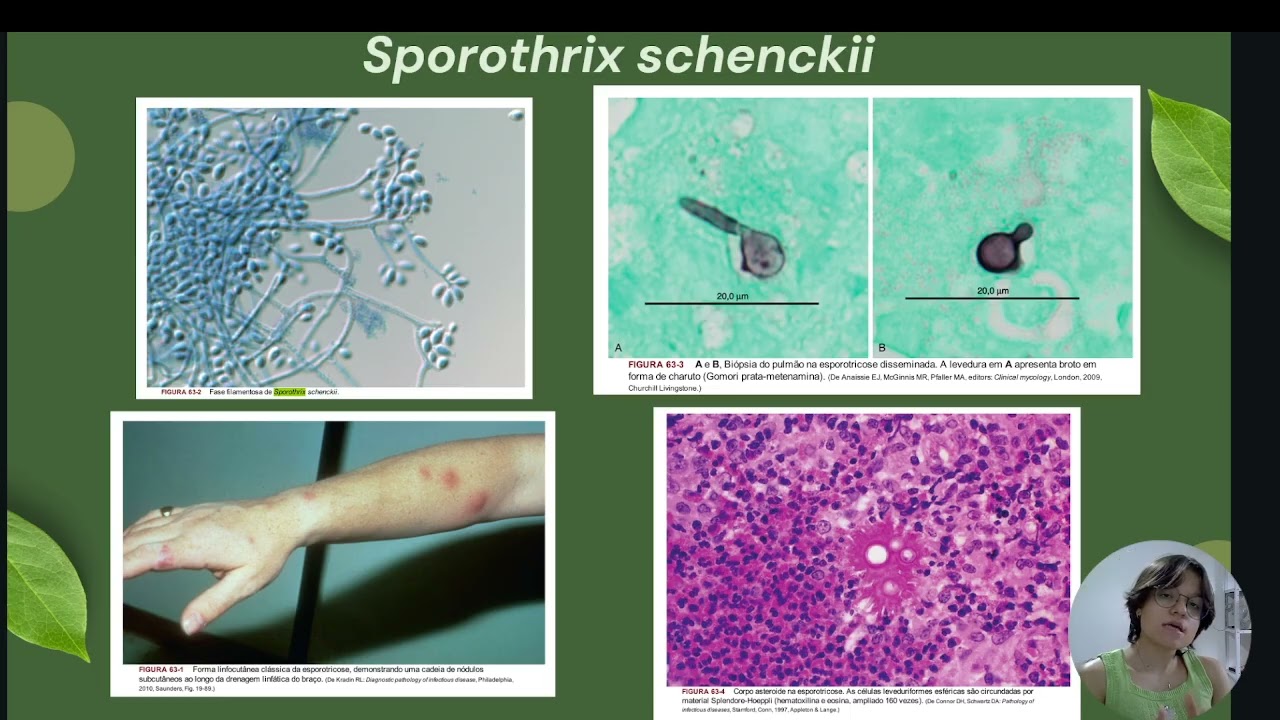 Fungos Patogênicos Dimórficos