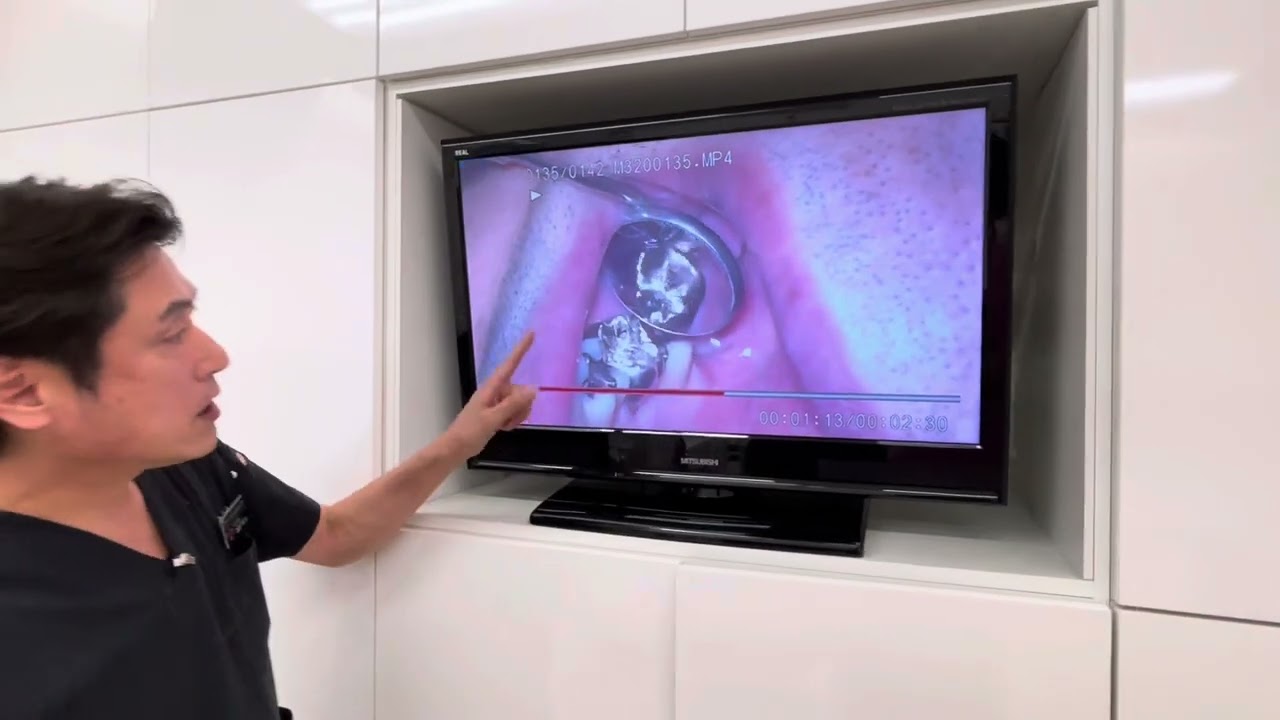 有賀正治の患者さんのためのマイクロスコープ活用術