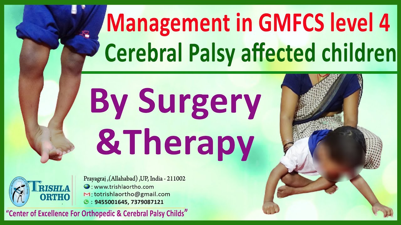 Management in GMFCS level 4 cerebral palsy affected children