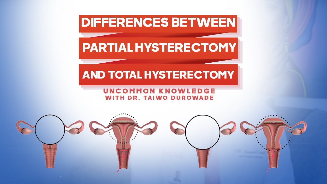 Differences Between Partial Hysterectomy and Total Hysterectomy?