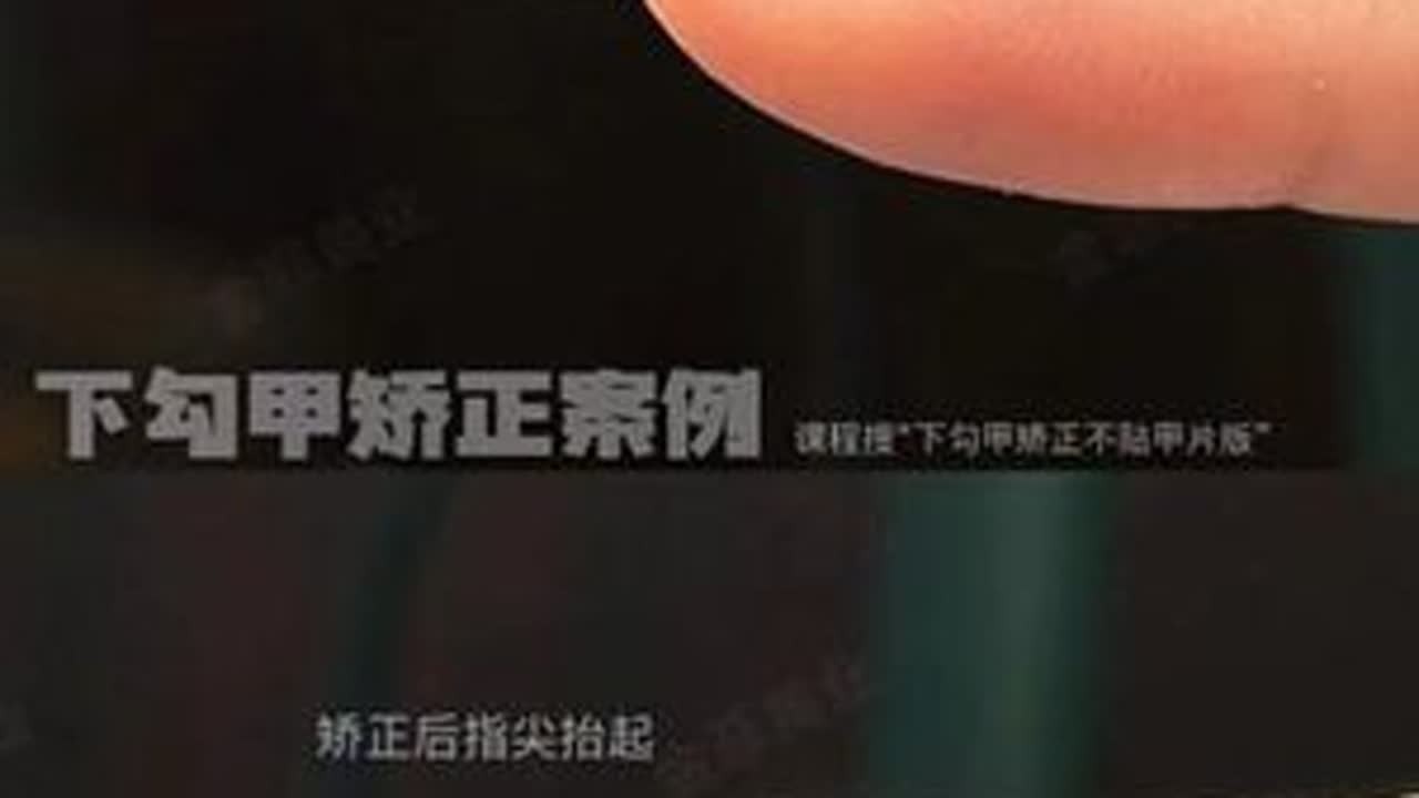 想要矫正下勾甲又不想贴甲片，快来学这个超级方便简单的甲模矫正方法！#金菲nail #下勾甲矫正 #甲膜延长