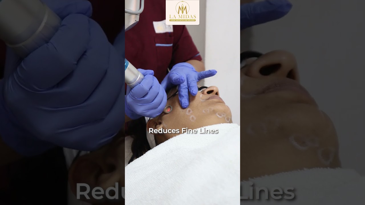 Laser Toning Treatment | La Midas Aesthetics