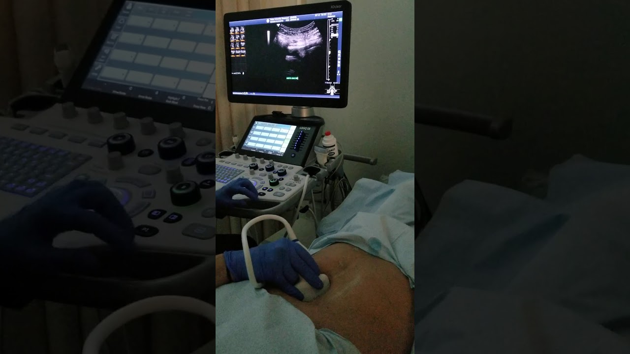 Aorta/IVC Protocol Demonstration