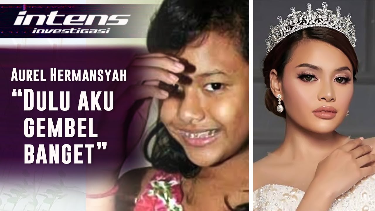 Wow, Perubahan Aurel Hermansyah dulu gembel sekarang Mempesona | Intens Investigasi