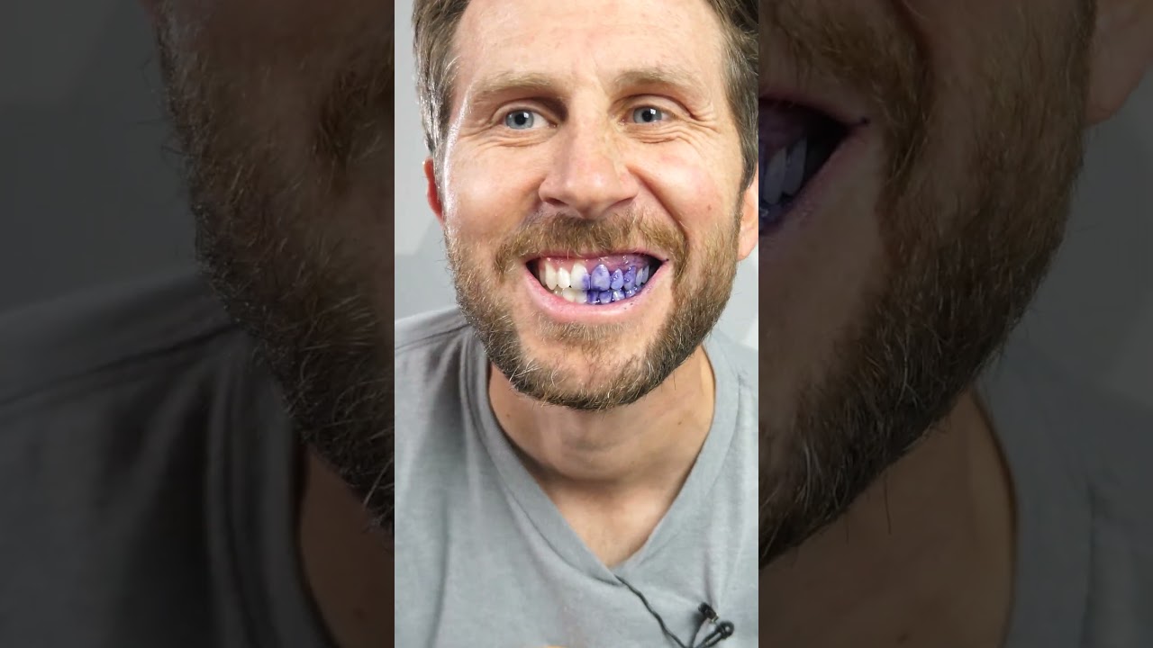Purple Teeth Scam