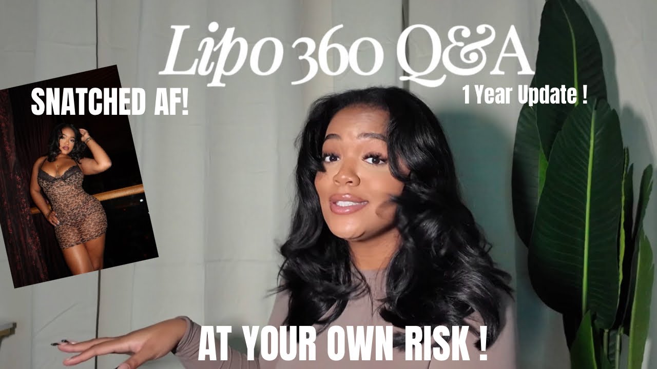 Lipo 360 Q&A : 1 year Post Op Dr. Kaufman