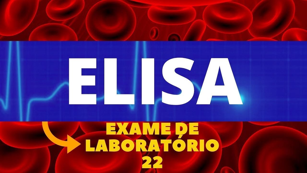 TESTE DE ELISA (EXAME DE ELISA) - IMUNOLOGIA-  PASSO A PASSO - EXAMES DE LABORAT&Oacute;RIO