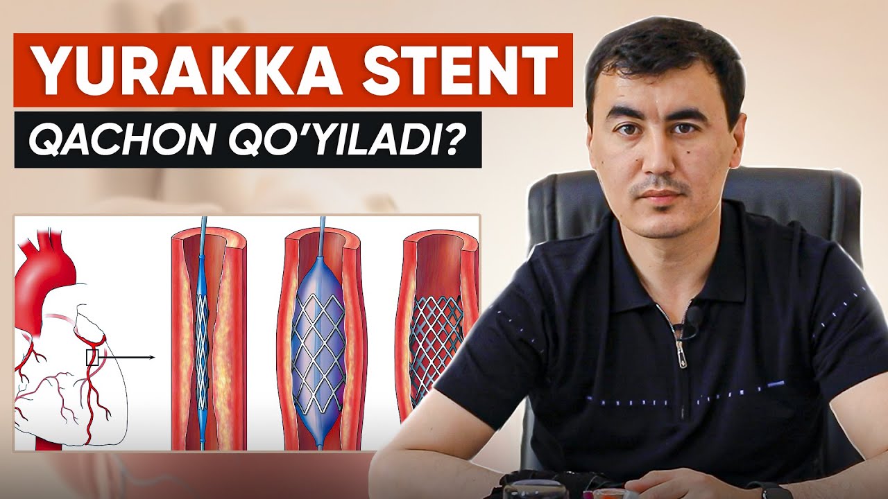 Yurakga stent qo'yish
